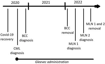 Covid-19, leukemia, and secondary malignancies of the skin – is there a connection: a case report and literature analysis